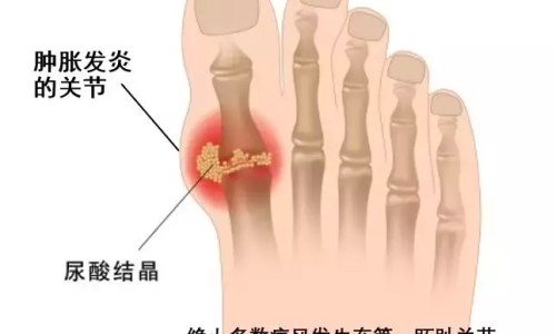 狗狗国产疫苗和进口疫苗区别网-分享狗狗国产疫苗和进口疫苗区别在哪，狗狗疫苗国产和进口哪个好知识库